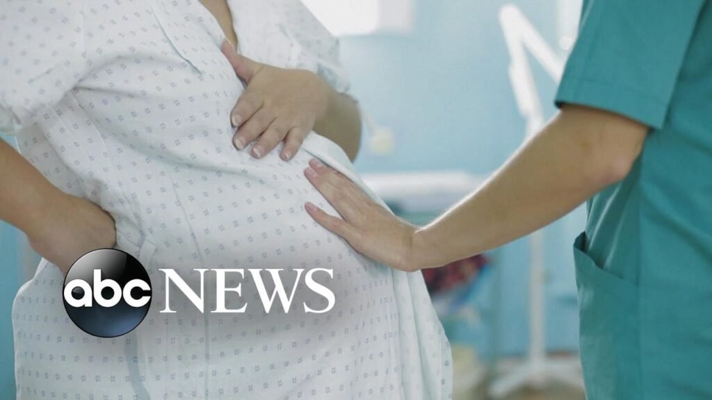 Roughly 7 million women in US have little-to-no access to maternity care