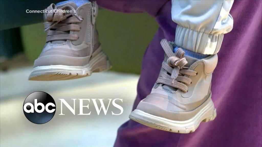 Hospitals in 36 states see spike in pediatric patients l GMA
