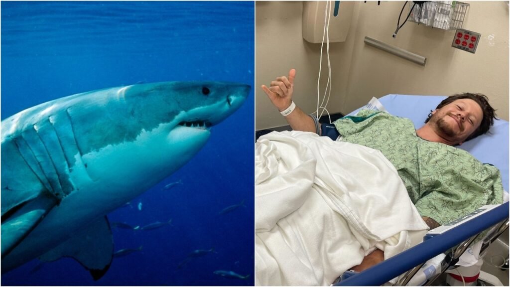 California man attacked by great white shark recounts terrifying moment: ‘My worst fear’