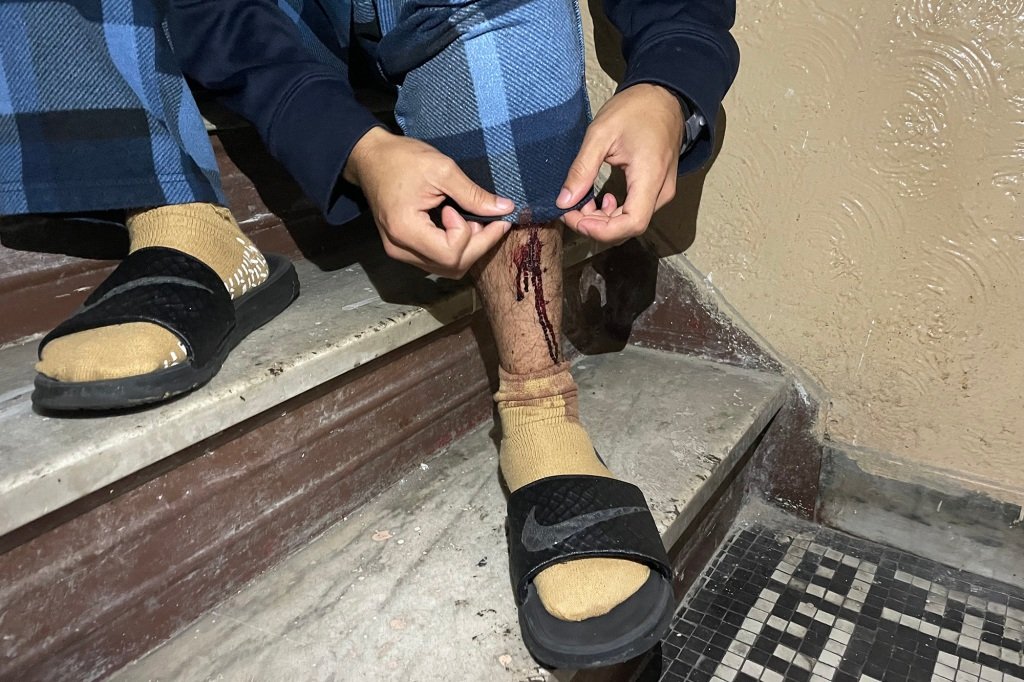 Tovar displays the slash wound on his left leg.
