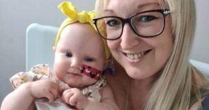 Baby’s brain tumour detected after mum notices extraordinary growth on her head
