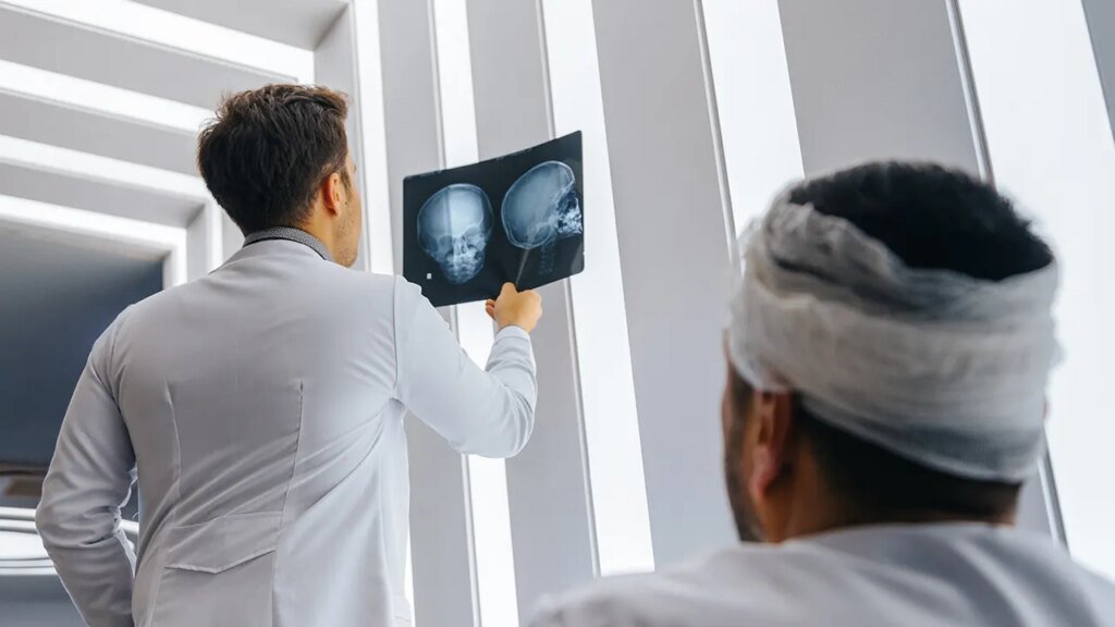 Head injury associated with doubled mortality rate, 30-year study reveals