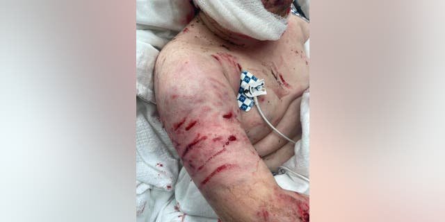 Justin Gilstrap will have undergone eight surgeries in the 21 days since his attack. He's expected to be in the hospital for at least another month.