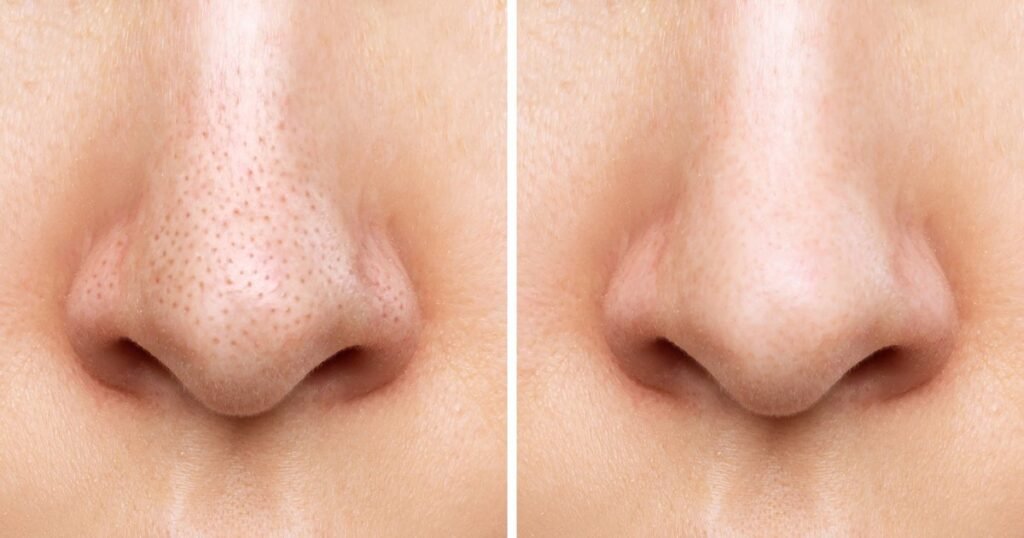 Pore Hack: This Refining Cream Could Reduce the Appearance of Pores in Just 8 Hours