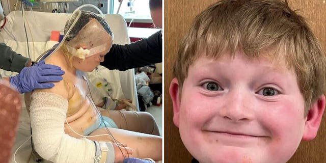 Justin Gilstrap is shown in two different pictures here. On Friday, Jan. 27, the boy is undergoing his eighth surgery, his mother wrote online to supporters.