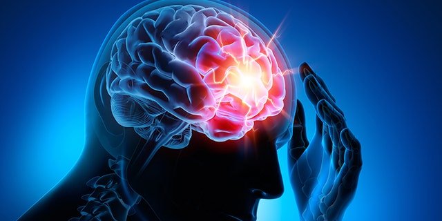 The study's implications "are that once you have a head injury (or if you are prone to one), your ability to function is compromised," Dr. Marc Siegel, a Fox News medical contributor, told Fox News Digital.