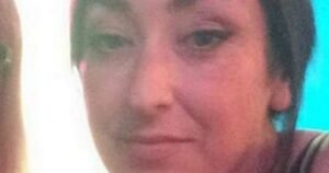 Mum’s skin ailment leaves her unable to cook, clean or drive without pain
