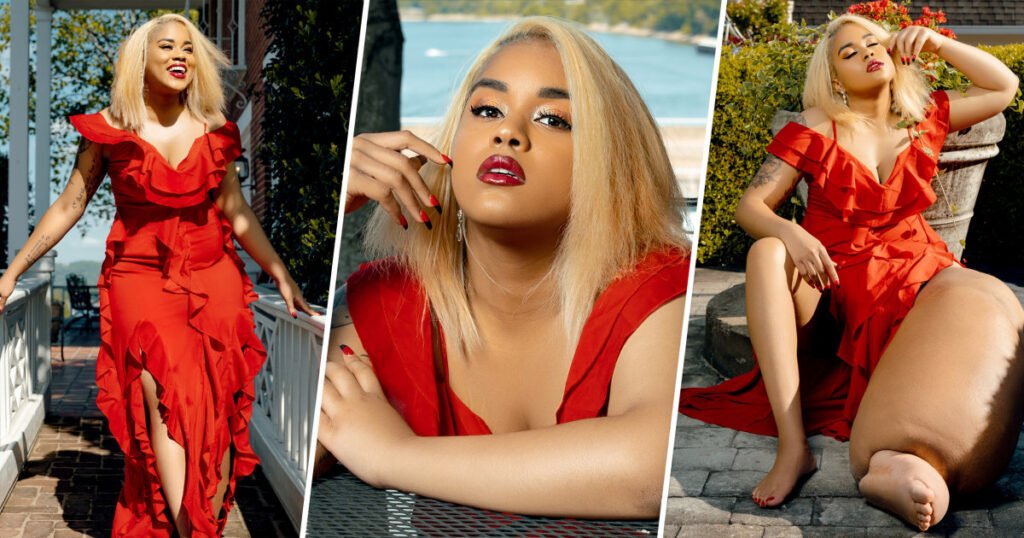 What Is Lymphedema? Model With 100-pound Leg Shares Symptoms